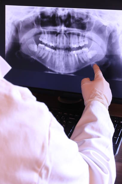 Best Emergency Gum Treatment in Yellville, AR