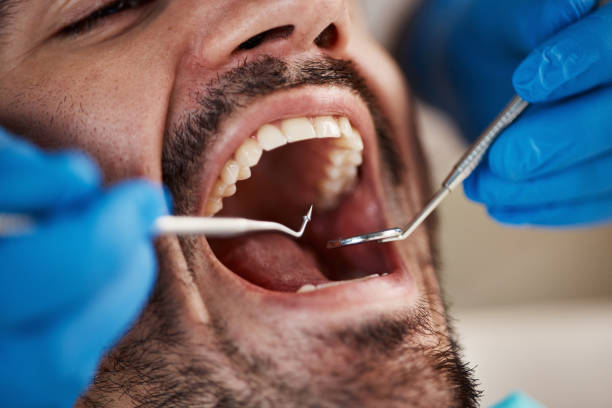 Best Urgent Care for Lost Fillings or Crowns in Yellville, AR